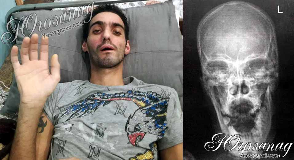 Да помогнем на Боби Ингилизов от Благоевград